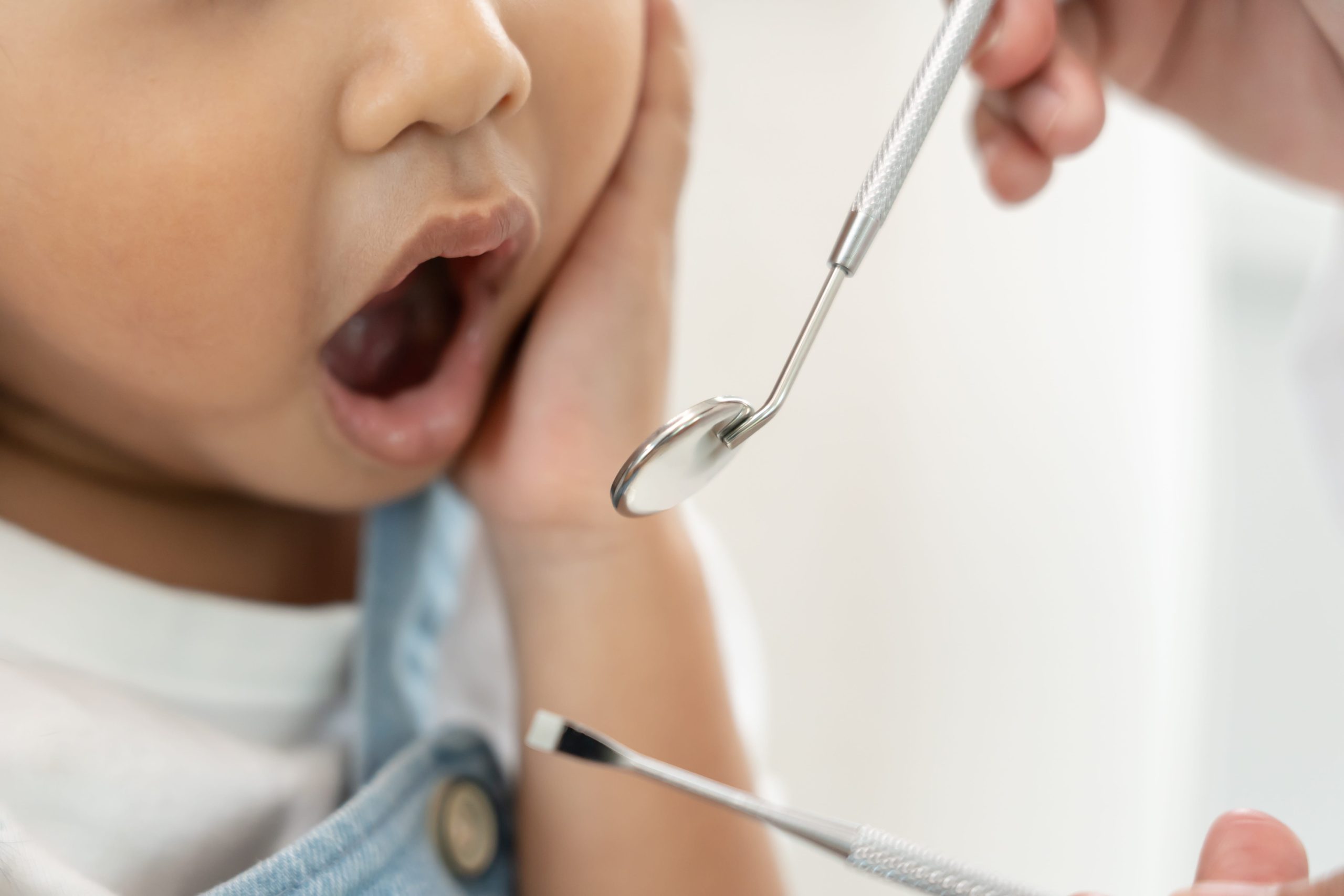 Children's dental fluoride care in Alexandria, VA